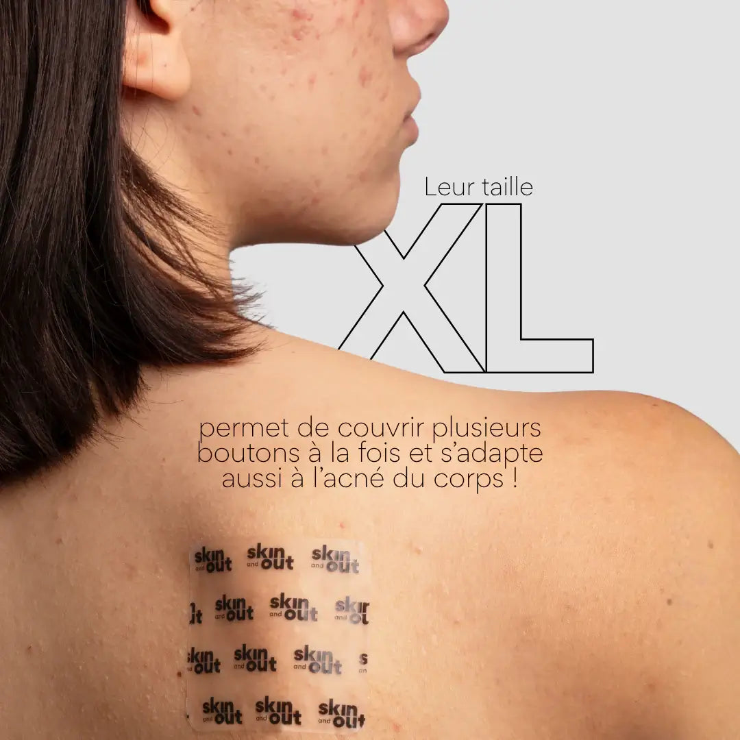 patchs visage stop boutons taille XL Skin & Out sur le dos