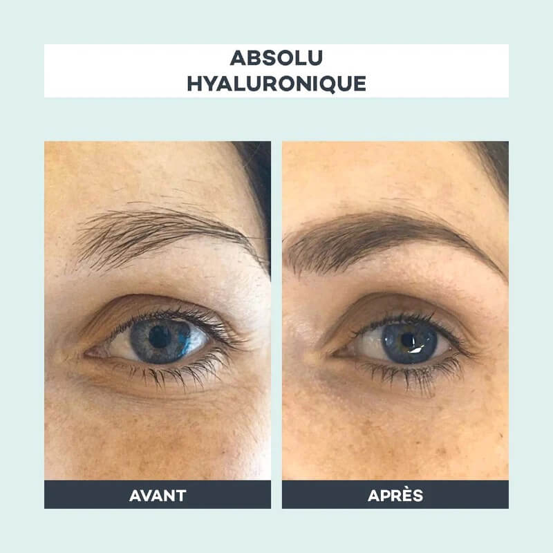 avant apres absolu hyaluronique d lab