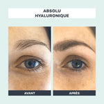 avant apres absolu hyaluronique d lab