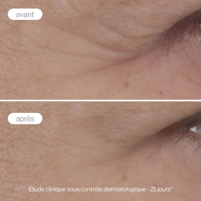 Étude clinique avant-après avec le contour des yeux anti-âge Novexpert