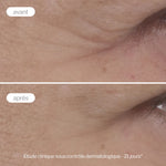Étude clinique avant-après avec le contour des yeux anti-âge Novexpert