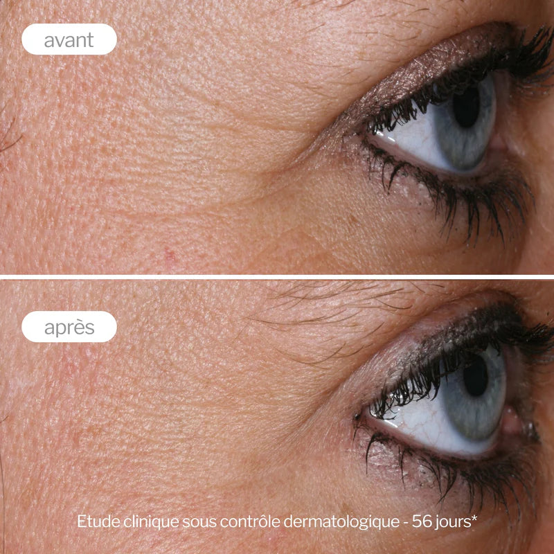 Étude clinique avant-après avec la crème anti-âge Novexpert