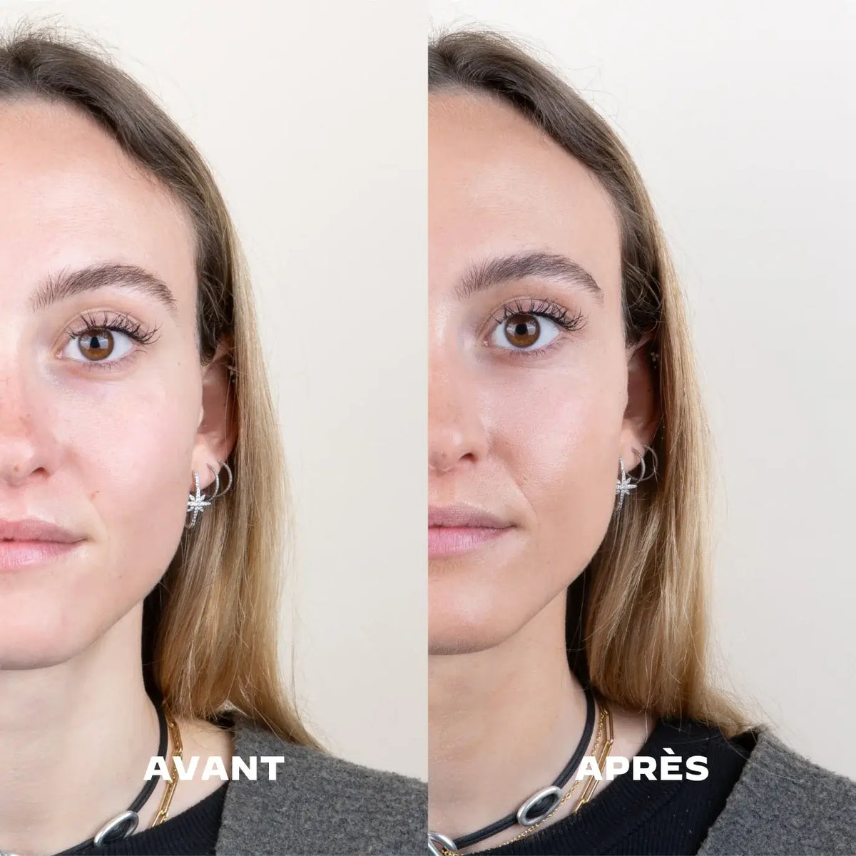 comparatif visage avant / après du sérum booster d'éclat soleil la Crique