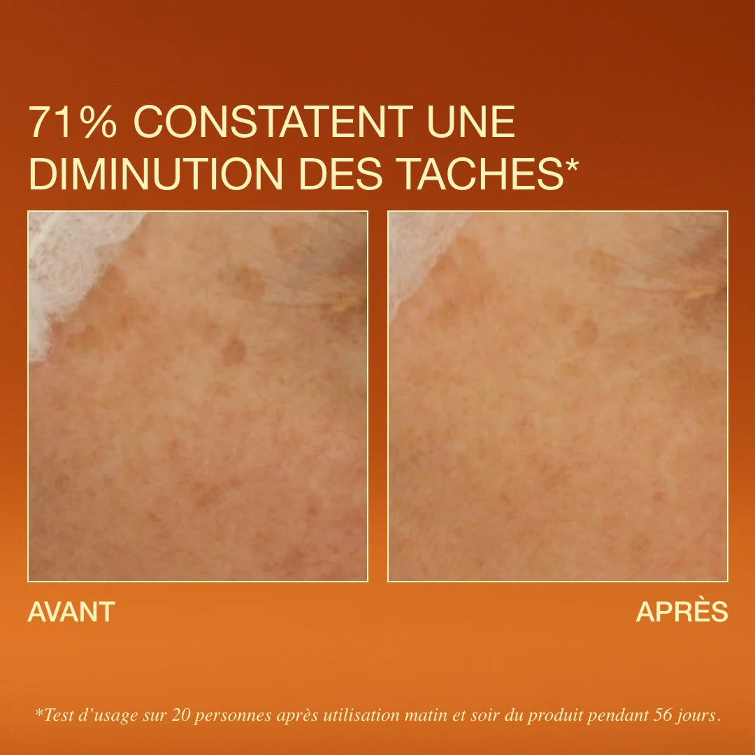 comparatif avant/après Sérum éclat Oden et anti-taches