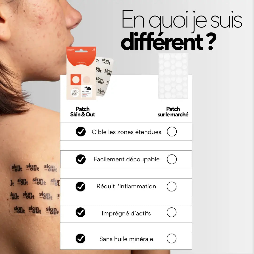 patchs visage stop boutons taille XL Skin & Out vs petits patchs