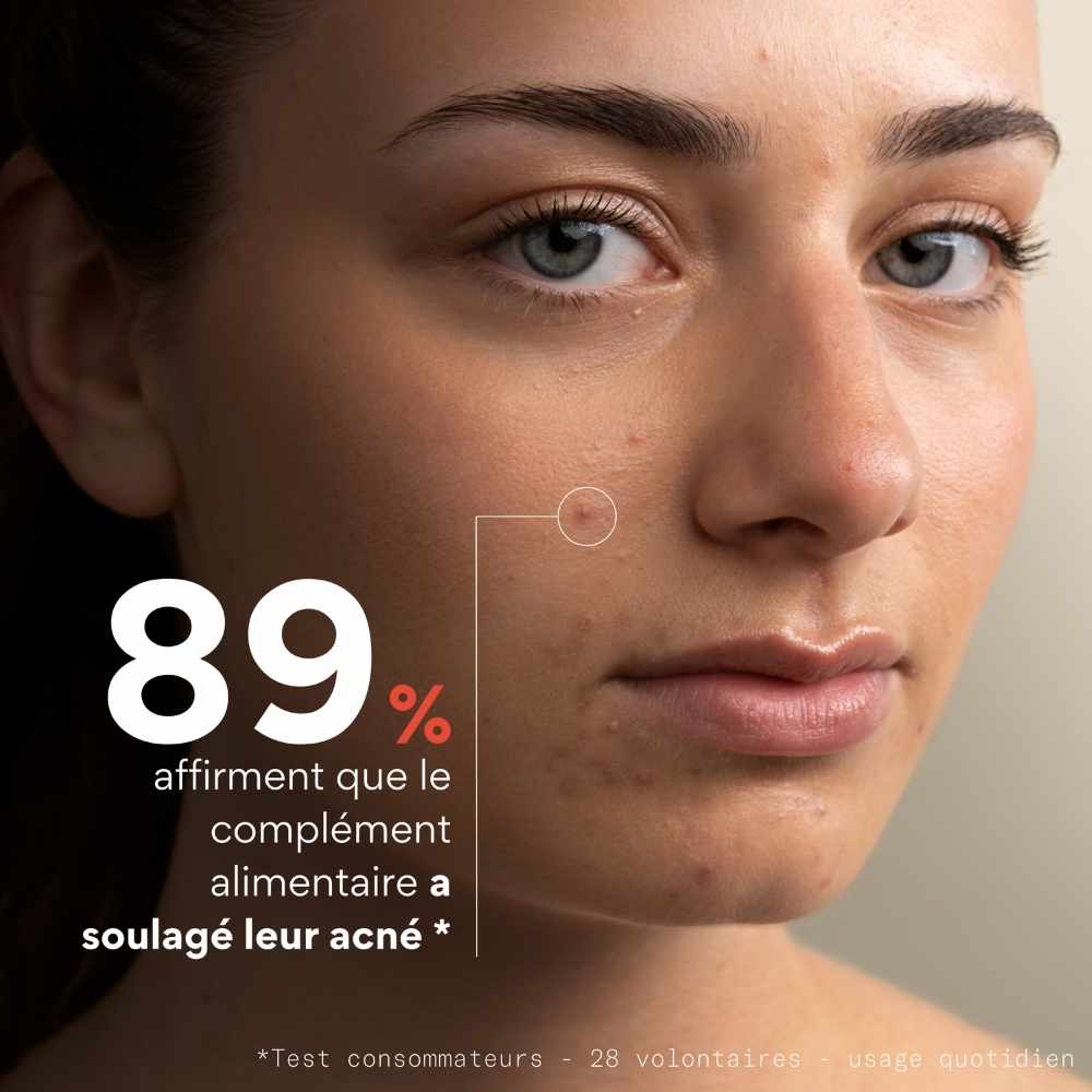 test consommateurs complément alimentaire anti-imperfections Clear In de Skin and Out