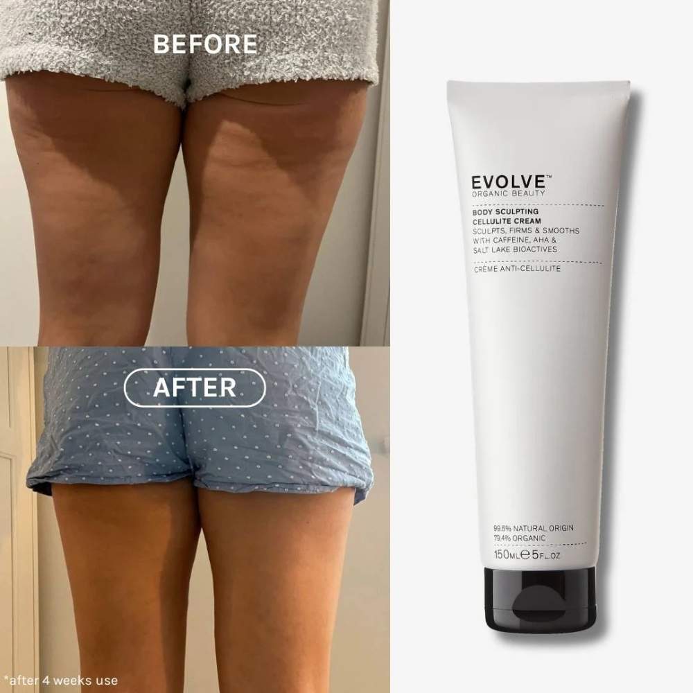 Résultats avant/après de la Crème anti-cellulite Body Sculpting Evolve Beauty