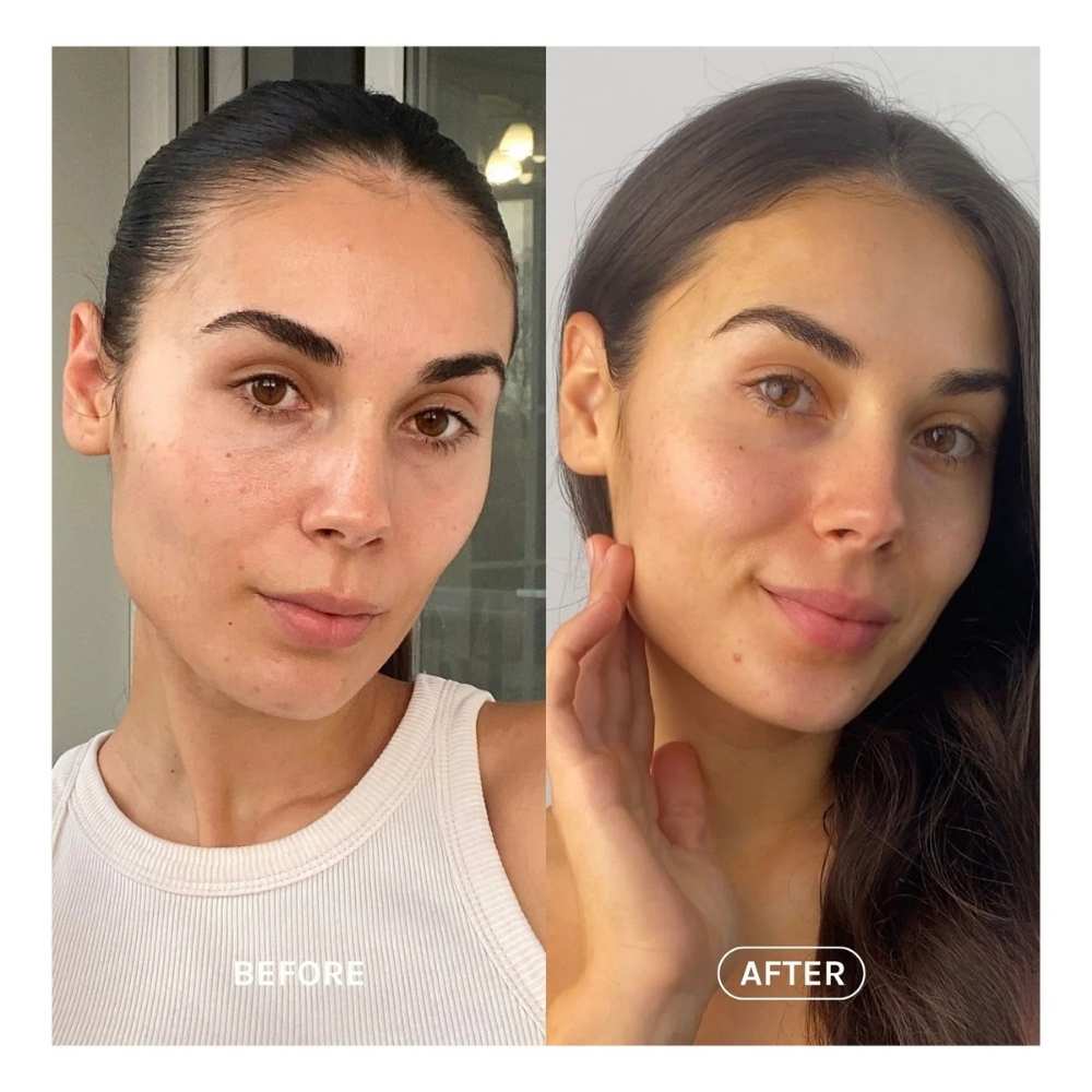 Résultats avant/après des Gouttes aubronzantes Evolve Beauty