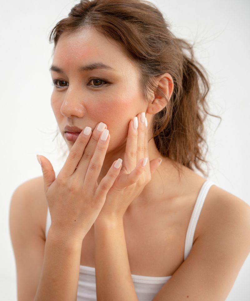 Jeune femme ayant la peau du visage tiraillée et rougit