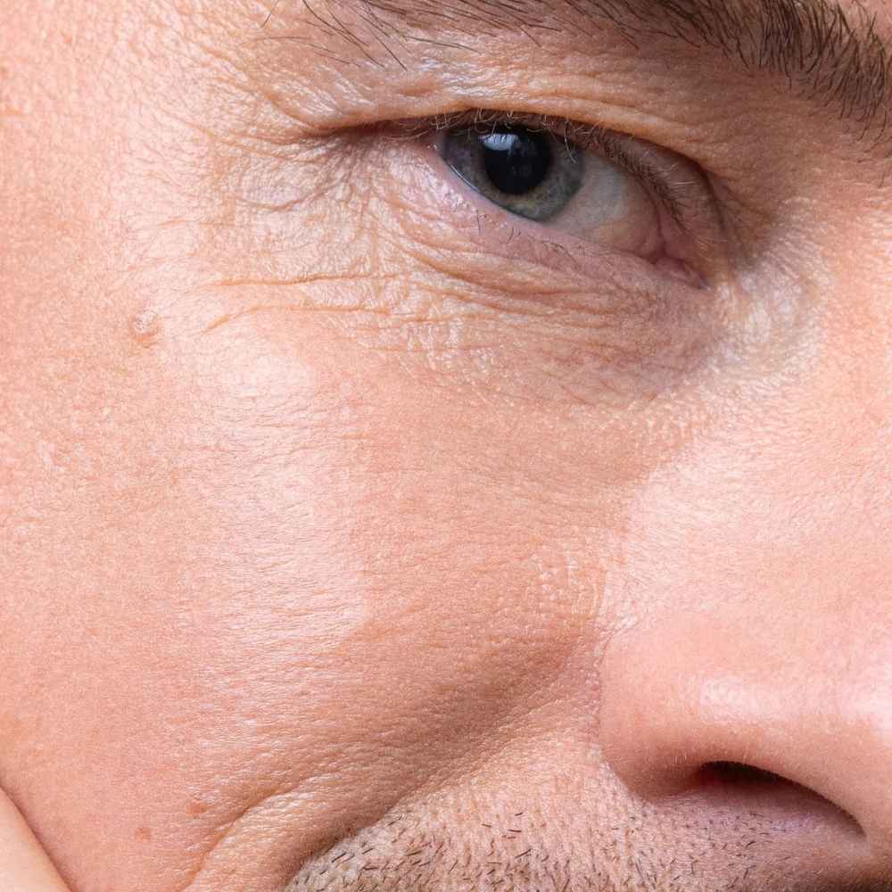 Rendu sur visage de la Teinte Moon Flower du Sérum teinté à l'acide hyaluronique H2O Tint de Mádara