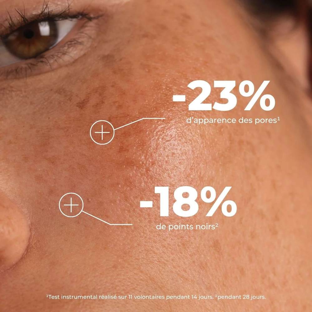 Gros plan de peau : -23 % d'apparence des pores et -18 % de points noirs avec le masque exfoliant