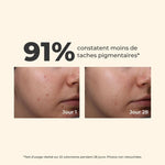 Avant/après au jour 1 et au jour 28 : 91 % constatent moins de taches pigmentaires