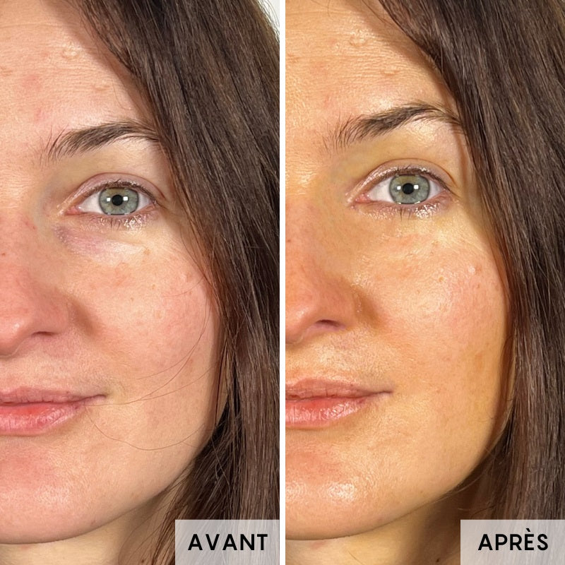 oden concentre d eglantier serum visage avant apres