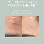 Les résultats de la pâte stop bouton On The Wild Side