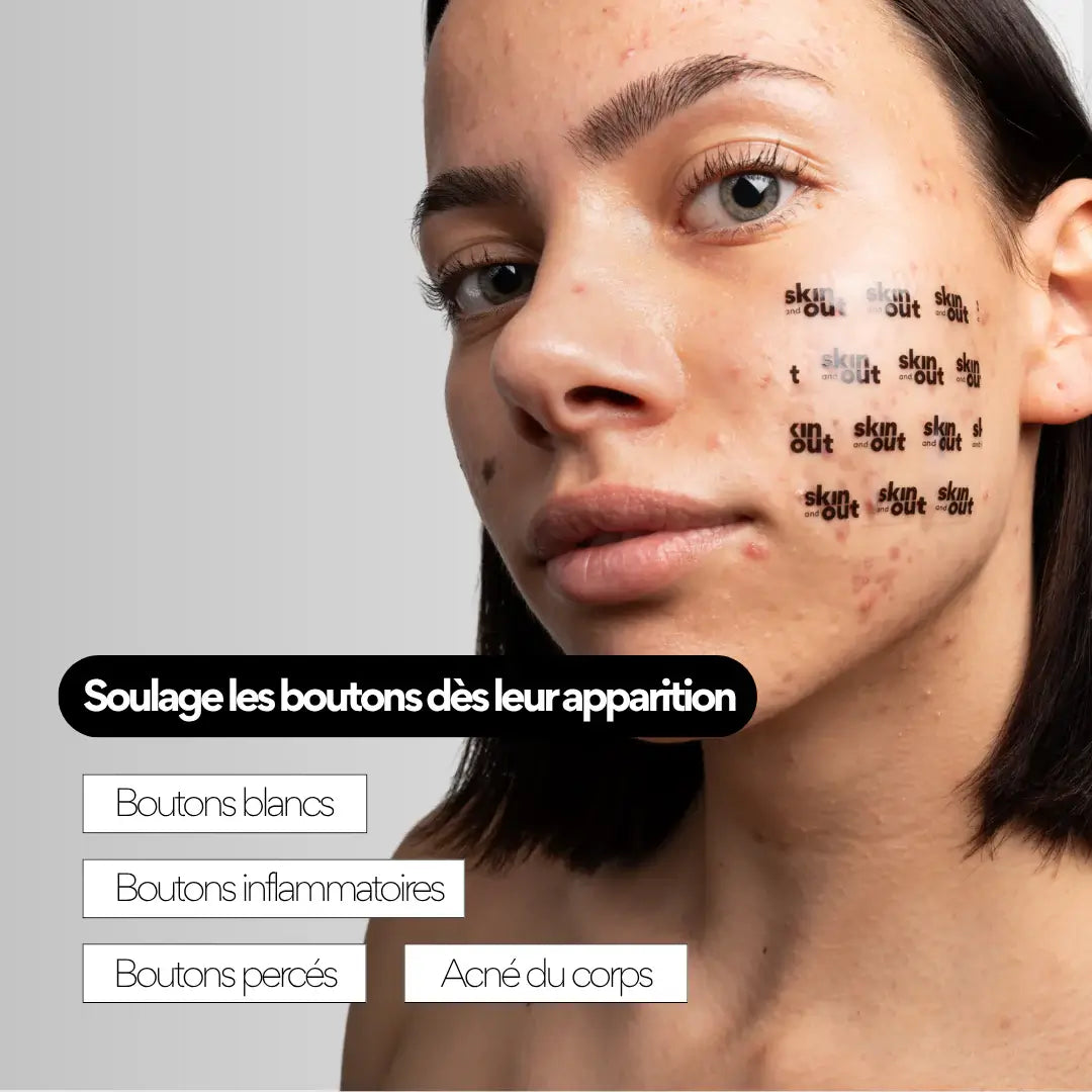 patchs visage stop boutons taille XL Skin & Out effets