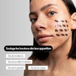 patchs visage stop boutons taille XL Skin & Out effets