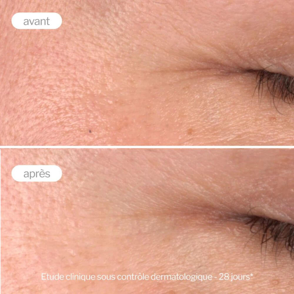 Sérum Booster Pro-Collagène Novexpert résultats