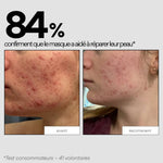 avant-après l'application du Masque réparateur Cica Out Skin and Out