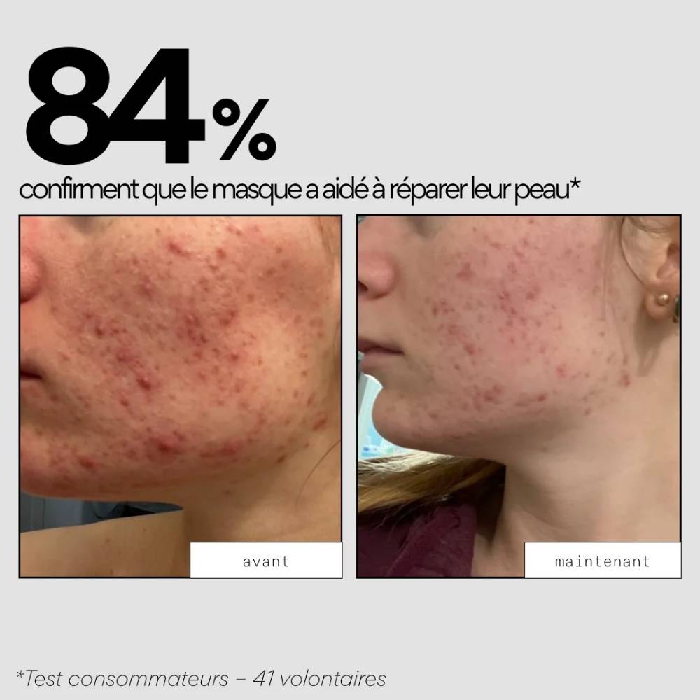 avant-après l'application du Masque réparateur Cica Out Skin and Out